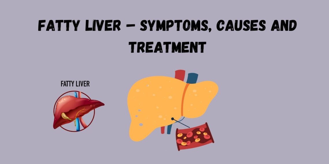 Fatty Liver – Symptoms, Causes and Treatment