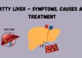 Fatty Liver – Symptoms, Causes and Treatment
